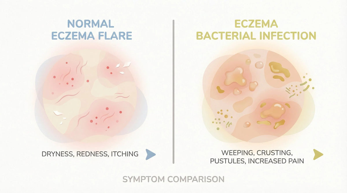 Eczema Bacterial Infection Symptoms: When to Act and What to Look For